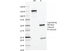 SDS-PAGE Analysis Purified Ferritin, Light Chain Mouse Monoclonal Antibody (FTL/1386). (FTL anticorps  (AA 38-165))