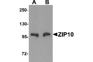 Western Blotting (WB) image for anti-Solute Carrier Family 39 (Zinc Transporter), Member 10 (SLC39A10) (Middle Region) antibody (ABIN1031176) (SLC39A10 anticorps  (Middle Region))