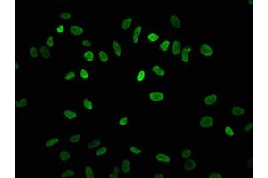 Immunofluorescence staining of Hela cells with ABIN7139182 at 1:7.