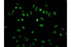 Immunofluorescence staining of Hela cells with ABIN7139182 at 1:7. (HIST1H3A anticorps  (acLys4))