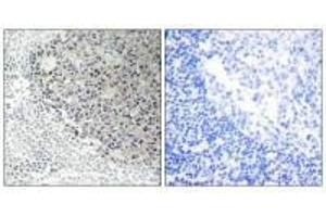 Immunohistochemistry analysis of paraffin-embedded human tonsil tissue using Collagen IX α3 antibody. (COL9A3 anticorps)