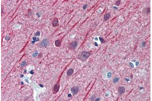 Human Brain, Cortex: Formalin-Fixed, Paraffin-Embedded (FFPE) (TUBB2A anticorps  (AA 1-446))