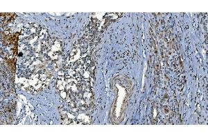 IHC analysis of GRX2/GLRX2 using anti-GRX2/GLRX2 antibody (ABIN7599022). (Glutaredoxin 2 anticorps  (AA 1-164))