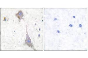 Immunohistochemistry (IHC) image for anti-Glutamate Receptor, Metabotropic 7 (GRM7) (C-Term) antibody (ABIN1848578)
