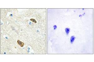 Immunohistochemical analysis of paraffin-embedded human brain tissue using PLXDC1 antibody. (PLXDC1 anticorps  (Internal Region))