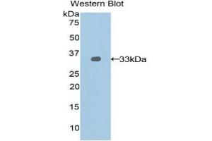 Detection of Recombinant NEXN, Rat using Polyclonal Antibody to Nexilin (NEXN)