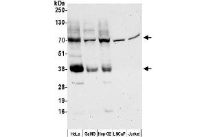 Western Blotting (WB) image for anti-Solute Carrier Family 16 (Monocarboxylic Acid Transporters), Member 3 (SLC16A3) (AA 400-450) antibody (ABIN7450438)
