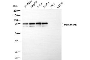 Western blotting analysis using metadherin antibody (ABIN7799375).