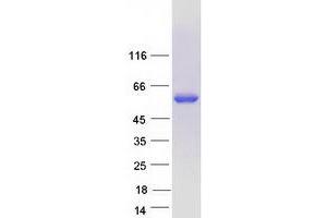 Validation with Western Blot