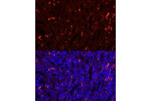 Immunofluorescence analysis of Mouse kidney using SLC4 antibody (7391 ) at dilution of 1:100. (Band 3/AE1 anticorps  (AA 1-353))