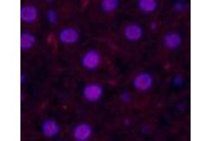 Immunofluorescence analysis of Rat liver tissue using Cleaved-CASP3 p17 (D175) Polyclonal Antibody at dilution of 1:200.