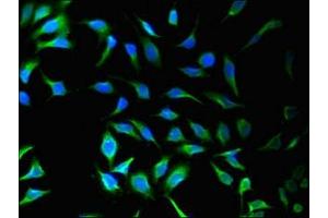 Immunofluorescent analysis of Hela cells using ABIN7170408 at dilution of 1:100 and Alexa Fluor 488-congugated AffiniPure Goat Anti-Rabbit IgG(H+L)