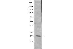 Western blot analysis of CENPR expression in A-431 cell lysate at 25ug/lane ,The lane on the left is treated with the antigen-specific peptide. (ITGB3BP anticorps  (Internal Region))