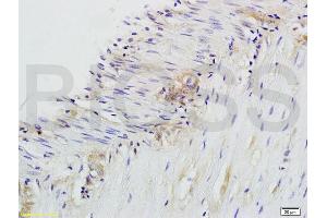 Formalin-fixed and paraffin embedded rat colitis labeled with Anti-CD28 Polyclonal Antibody, Unconjugated (ABIN674604) at 1:200 followed by conjugation to the secondary antibody and DAB staining. (CD28 anticorps  (AA 1-120))