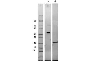 SDS-PAGE of Mouse Vascular Endothelial Growth Factor-165 Recombinant Protein SDS-PAGE of Mouse Vascular Endothelial Growth Factor-165 Recombinant Protein. (VEGF 165 Protéine)