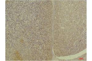 Immunohistochemistry (IHC) analysis of paraffin-embedded Human Pancreas Tissue using GLP1R Rabbit Polyclonal Antibody diluted at 1:200. (GLP1R anticorps)