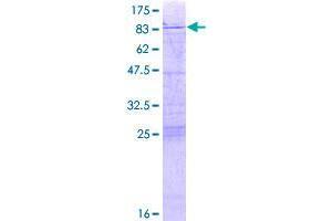 Image no. 1 for Zinc Finger Protein 519 (ZNF519) (AA 1-540) protein (GST tag) (ABIN1326259)