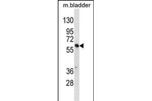 SNX30 Antibody (C-term) (ABIN1537180 and ABIN2849996) western blot analysis in mouse bladder tissue lysates (35 μg/lane). (SNX30 anticorps  (C-Term))