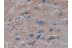 Detection of PKBb in Human Liver Tissue using Polyclonal Antibody to Protein Kinase B Beta (PKBb)