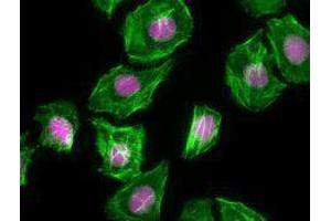 Immunofluorescence (IF) image for anti-Antigen Identified By Monoclonal Antibody Ki-67 (MKI67) antibody (Alexa Fluor 647) (ABIN2657968) (Ki-67 anticorps  (Alexa Fluor 647))