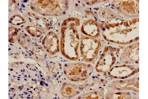 Immunohistochemistry analysis of human kidney tissue using ABIN7147255 at dilution of 1:100 (RAD9A anticorps  (AA 267-341))