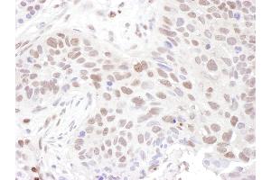 anti-Zinc Finger Protein 462 (ZNF462) (AA 2456-2506) antibody