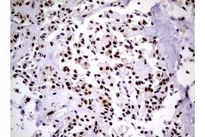 Image no. 19 for anti-Nibrin (NBN) (AA 183-460) antibody (ABIN1491058)