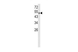 Western blot analysis of CYP8A1 Antibody (C-term) (ABIN652421 and ABIN2842087) in CEM cell line lysates (35 μg/lane).