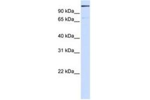 Image no. 1 for anti-Tankyrase 1 Binding Protein 1, 182kDa (TNKS1BP1) (AA 1512-1561) antibody (ABIN6744262) (TNKS1BP1 anticorps  (AA 1512-1561))