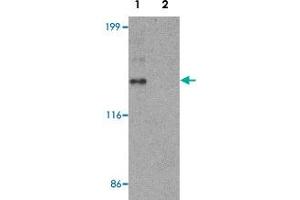 Western blot analysis of HeLa cell lysate with ZNF521 polyclonal antibody  at 1 ug/mL in (1) the absence and (2) the presence of blocking peptide. (ZNF521 anticorps  (N-Term))
