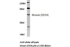 Western blot (WB) analysis of Moesin antibody in extracts from A549 cells. (Moesin anticorps)
