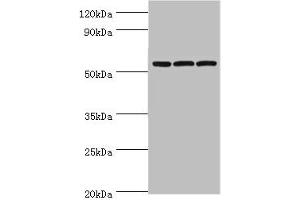 Western blot All lanes: Alpha-amylase 2B antibody at 8 μg/mL Lane 1: Mouse skeletal muscle tissue Lane 2: HL60 whole cell lysate Lane 3: K562 whole cell lysate Secondary Goat polyclonal to rabbit IgG at 1/10000 dilution Predicted band size: 58, 43 kDa Observed band size: 58 kDa (AMY2B anticorps  (AA 16-320))