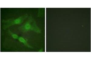 Immunofluorescence analysis of HeLa cells, using PKC zeta (Phospho-Thr410) Antibody.