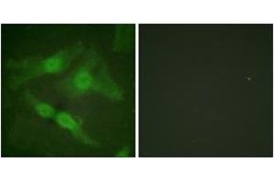 Immunofluorescence analysis of HeLa cells, using PKC zeta (Phospho-Thr410) Antibody. (PKC zeta anticorps  (pThr410))