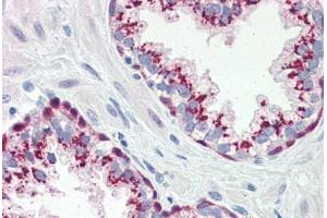 Human Prostate (formalin-fixed, paraffin-embedded) stained with Heat Shock Protein 70 (HSP70) antibody ABIN364327 at 10 ug/ml followed by biotinylated anti-mouse IgG secondary antibody ABIN481714, alkaline phosphatase-streptavidin and chromogen. (HSP70 anticorps  (AA 1-641))