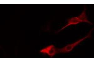 ABIN6274816 staining LOVO cells by IF/ICC. (ARF4 anticorps  (Internal Region))