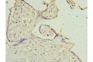 Immunohistochemistry of paraffin-embedded human placenta tissue using ABIN7156942 at dilution of 1:100 (IL9 Receptor anticorps  (AA 272-521))