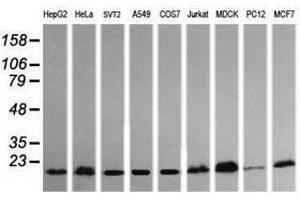 Image no. 1 for anti-HRas proto-oncogene, GTPase (HRAS) antibody (ABIN1498715) (HRAS anticorps)