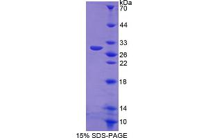 Image no. 1 for Nitric Oxide Synthase 2, Inducible (NOS2) (AA 734-966) protein (His tag) (ABIN4988536) (NOS2 Protein (AA 734-966) (His tag))