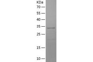 Western Blotting (WB) image for Wilms Tumor 1 (WT1) (AA 157-445) protein (His tag) (ABIN7125729)