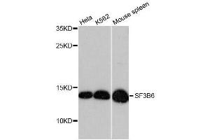 Western blot analysis of extracts of various cell lines, using SF3B6 antibody. (Pre-mRNA Branch Site Protein p14 (SF3B14) (AA 1-125) anticorps)