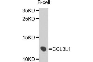 Western blot analysis of extracts of B cells, using CCL3L1 antibody. (CCL3L1 anticorps)