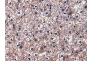 Detection of F1+2 in Human Liver Tissue using Monoclonal Antibody to Prothrombin Fragment 1+2 (F1+2)