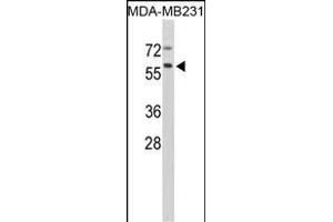 Western blot analysis of CTSF Antibody (Center ) (ABIN390488 and ABIN2840848) in MDA-M cell line lysates (35 μg/lane). (Cathepsin F anticorps  (AA 261-290))
