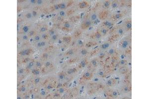 Used in DAB staining on fromalin fixed paraffin- embedded liver tissue