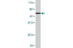Western Blot detection against Immunogen (66. (Septin 1 anticorps  (AA 1-367))