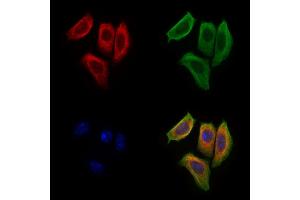 ABIN6265207 and ABIN6277244 staining Hela cells by IF/ICC.