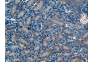 Detection of MMP12 in Mouse Kidney Tissue using Polyclonal Antibody to Matrix Metalloproteinase 12 (MMP12)