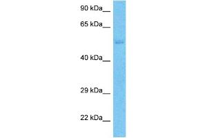 Host:  Rabbit  Target Name:  SLC43A3  Sample Type:  Jurkat Whole Cell lysates  Antibody Dilution:  1. (SLC43A3 anticorps  (N-Term))