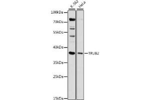 Western blot analysis of extracts of various cell lines, using TRUB2 antibody (ABIN7271015) at 1:1000 dilution. (TRUB2 anticorps  (AA 122-331))
